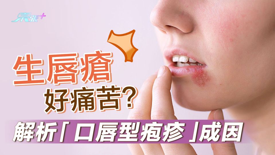 生唇瘡好痛苦？解析「口唇型疱疹」成因