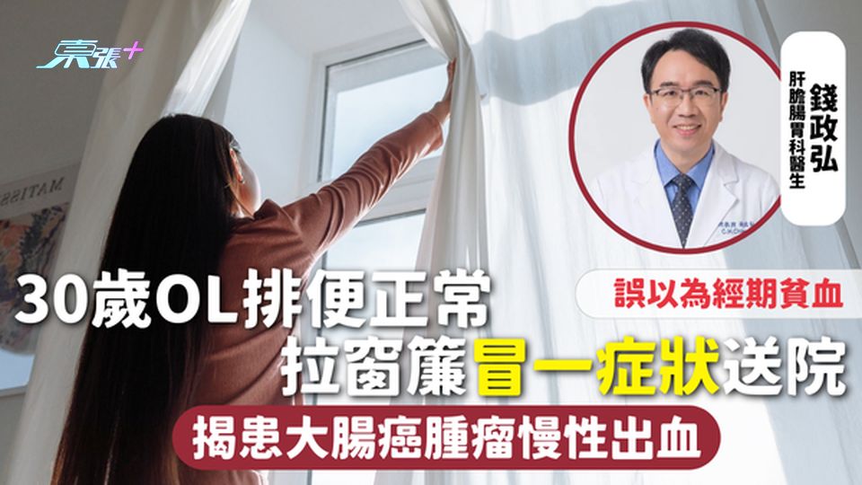 大腸癌 | 30歲OL排便正常 拉窗簾冒一症狀送院 揭患大腸癌腫瘤慢性出血 誤以為經期貧血
