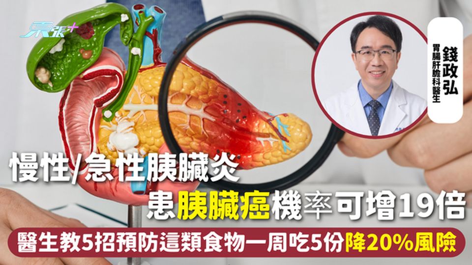 胰臟癌 | 慢性/急性胰臟炎 患胰臟癌機率可增19倍 醫生教5招預防 這類食物一周吃5份降20%風險