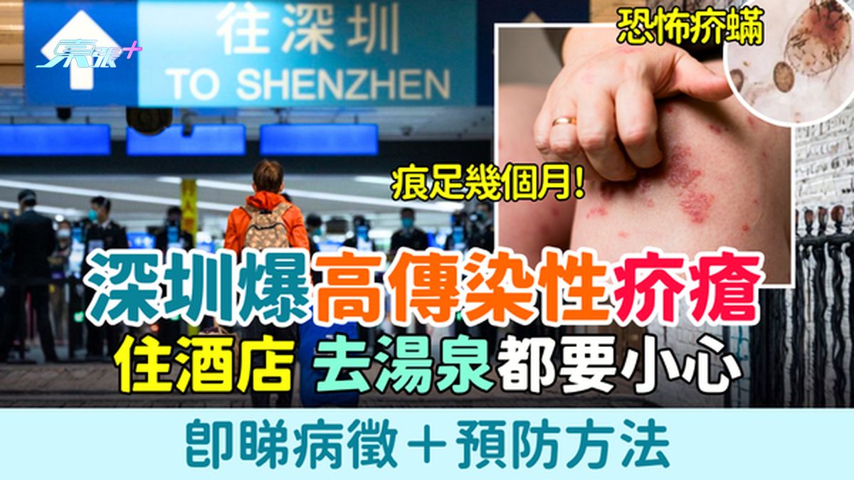 北上注意｜深圳多區爆高傳染性疥瘡 痕足幾個月！住酒店、去湯泉都要小心 即睇病徵與預防方法
