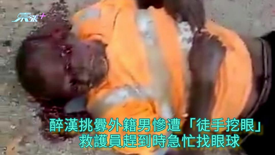 慘遭挖眼 | 醉漢挑釁外籍男慘遭「徒手挖眼」 救護員趕到時急忙找眼球