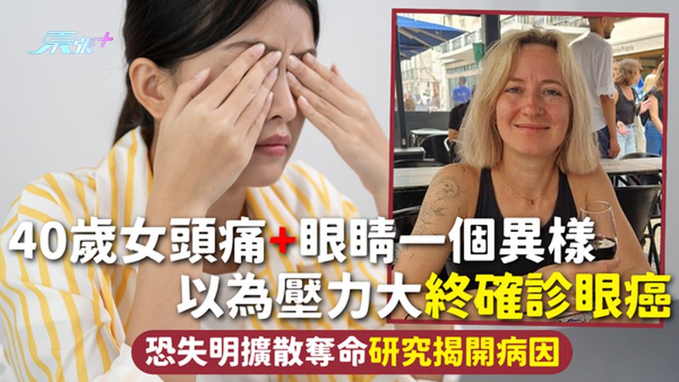 眼癌 | 40歲女頭痛+眼睛一個異樣 以為壓力大終確診眼癌 恐失明擴散奪命研究揭開病因  