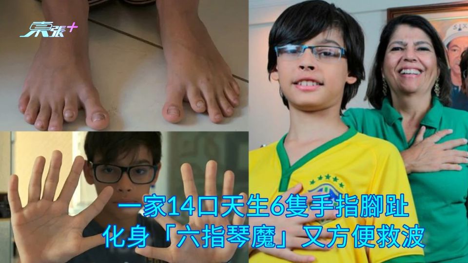 一家14口天生6隻手指腳趾 化身「六指琴魔」又方便救波
