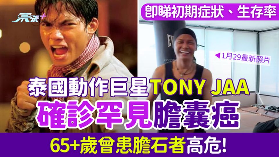 膽囊癌｜泰國動作巨星Tony Jaa確診罕見膽囊癌 65+歲曾患膽石者高危！即睇初期症狀、生存率