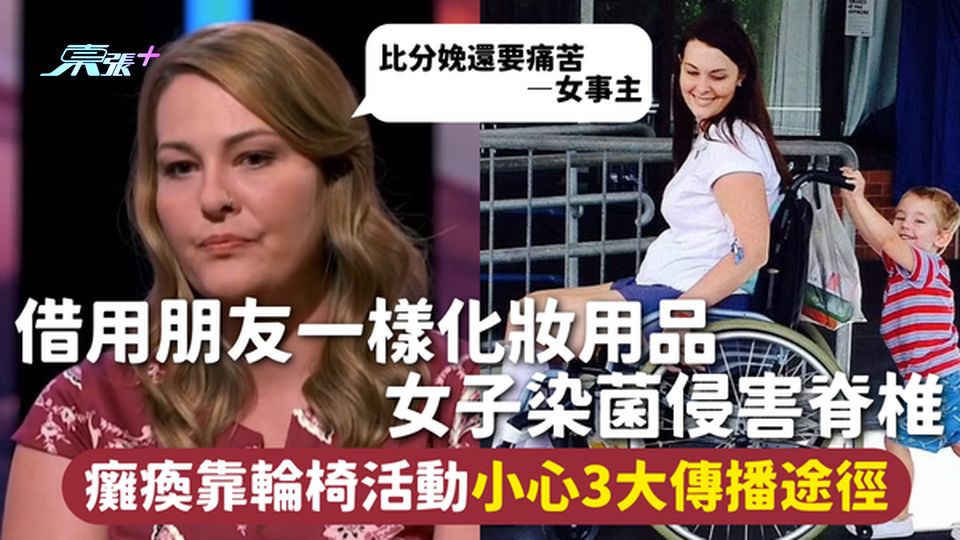 借用朋友一樣化妝用品 女子染菌侵害脊椎 癱瘓靠輪椅活動小心3大傳播途徑