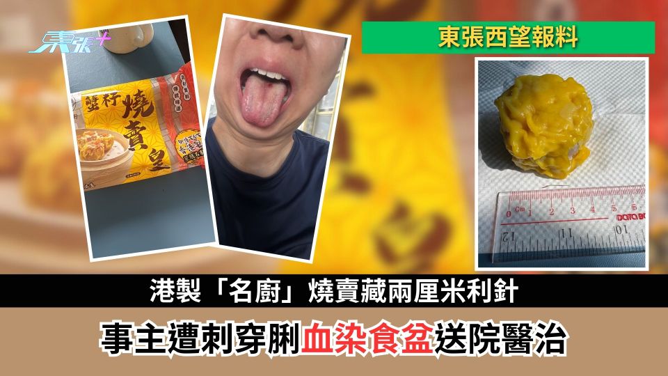東張西望報料｜港製「名廚」燒賣藏兩厘米利針　事主遭刺穿脷血染食盆送院醫治