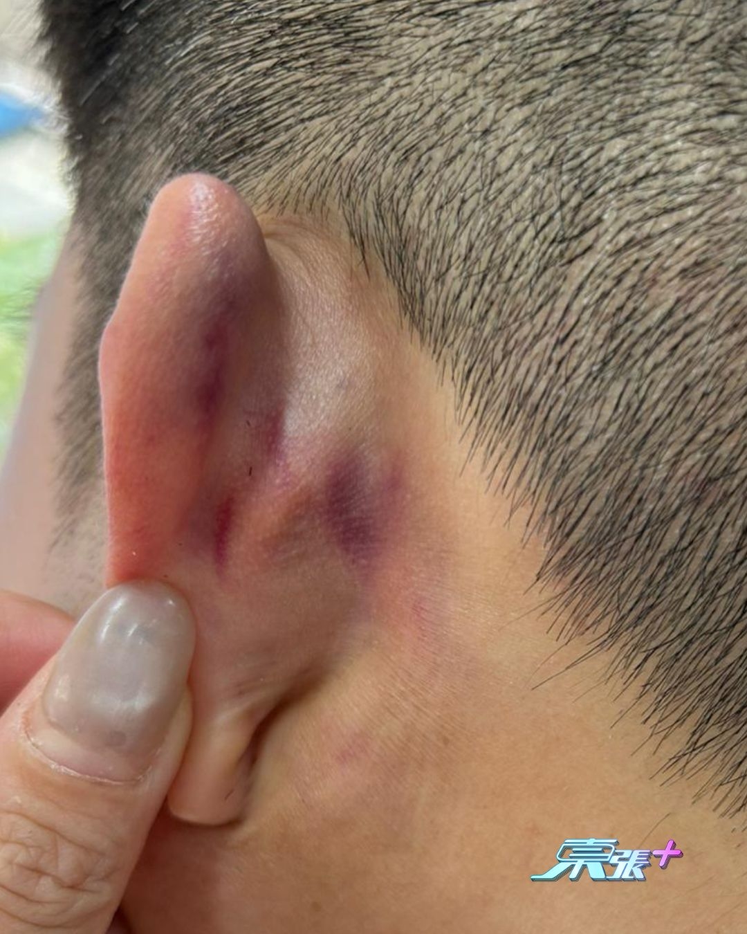 筲箕灣MMA｜員工慘被狂毆　今回應「東張+」已報警　事主：今日又嘔又暈