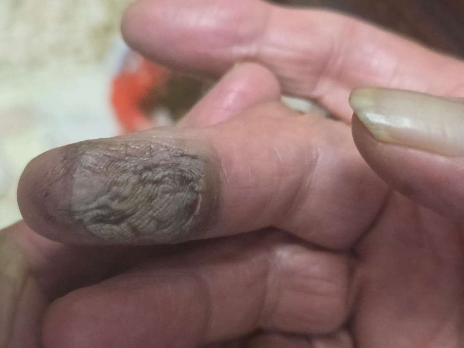 No photo description available.