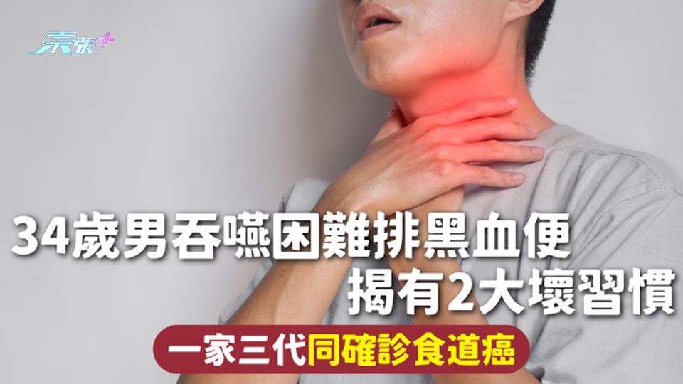 食道癌 | 34歲男吞嚥困難排黑血便 揭有2大壞習慣 一家三代同確診食道癌