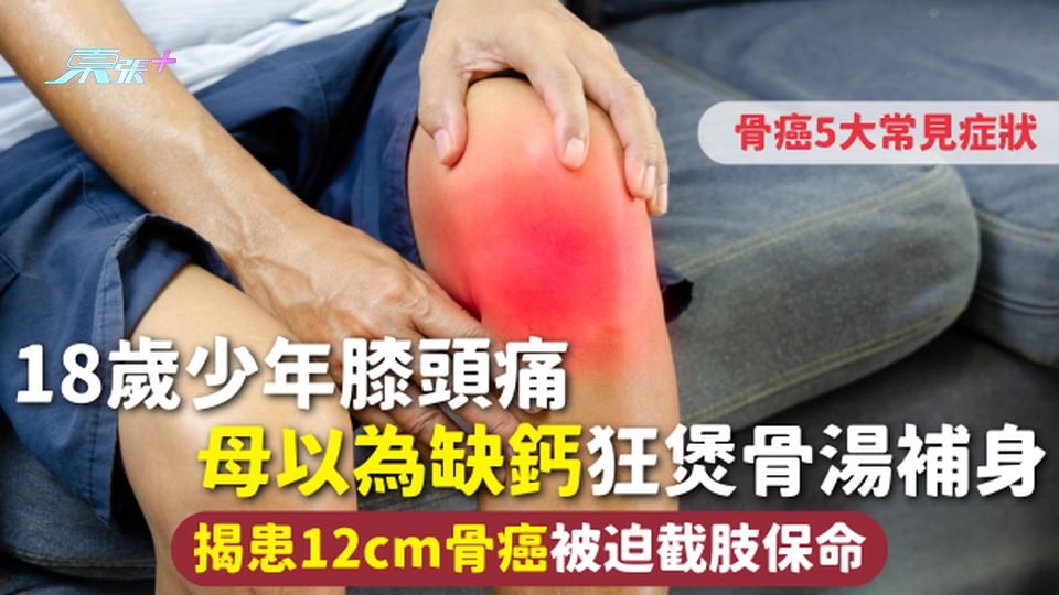 骨癌 | 18歲少年膝頭痛 母以為缺鈣狂煲骨湯補身 揭患12cm骨癌被迫截肢保命 附5大常見症狀