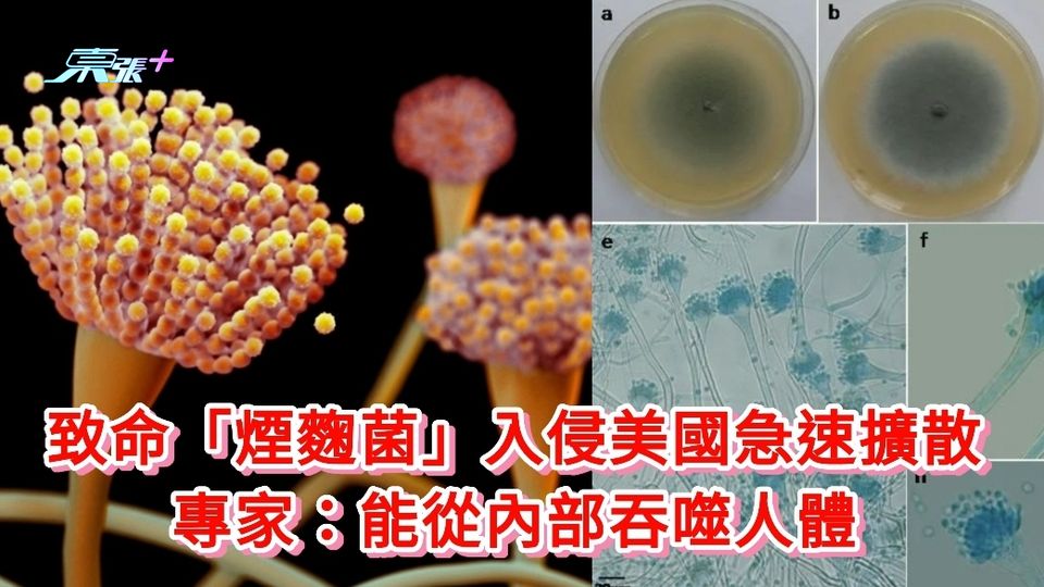 致命「煙麴菌」入侵美國急速擴散 專家：能從內部吞噬人體