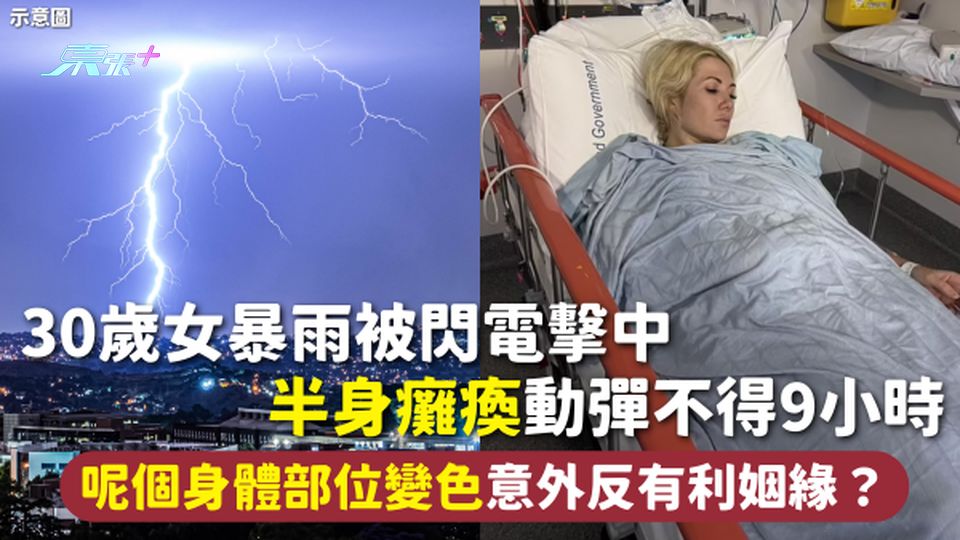 閃電意外 | 30歲女暴雨被閃電擊中 半身癱瘓動彈不得9小時 呢個身體部位變色 意外反有利姻緣？