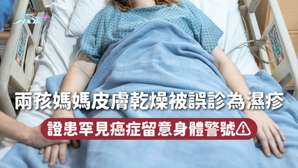 兩孩媽媽皮膚乾燥被誤診為濕疹 證患罕見癌症留意身體警號⚠️