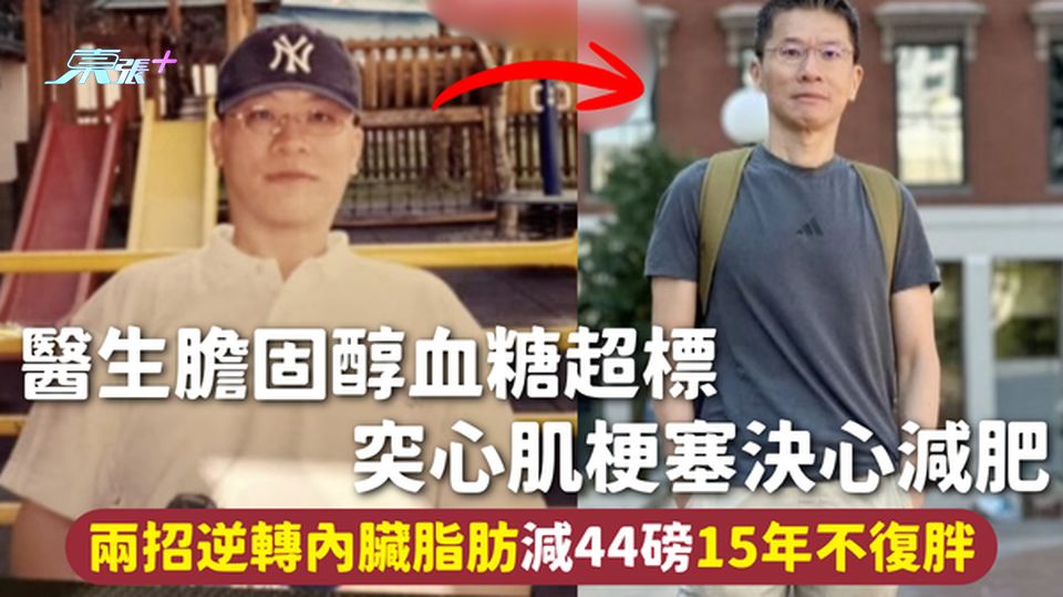 健康習慣 | 醫生膽固醇血糖超標 突心肌梗塞決心減肥 兩招逆轉內臟脂肪減44磅15年不復胖