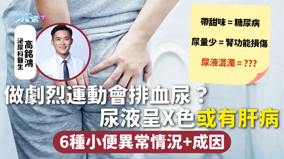小便異常 | 做劇烈運動會排血尿？ 尿液呈X色或有肝病 6種小便異常情況+成因