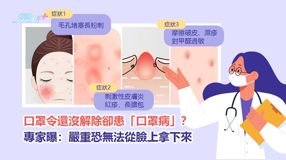 口罩令還沒解除卻患「口罩病」？專家：嚴重恐無法從臉上拿下來