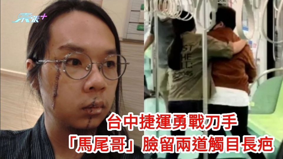 台中捷運勇戰刀手的「馬尾哥」傷情曝光 臉留兩道觸目長疤