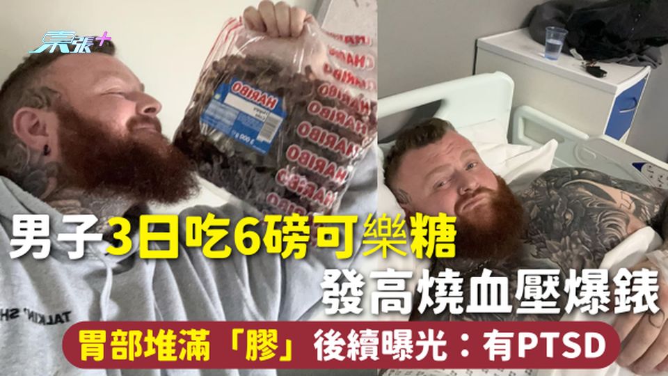 飲食健康 | 男子3日吃6磅可樂糖 發高燒血壓爆錶 胃部堆滿「膠」後續曝光：有PTSD