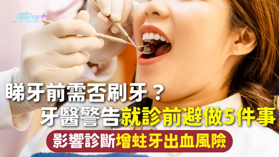 睇牙 | 看牙前需否刷牙？牙醫警告就診前避做5件事 影響診斷增蛀牙出血風險