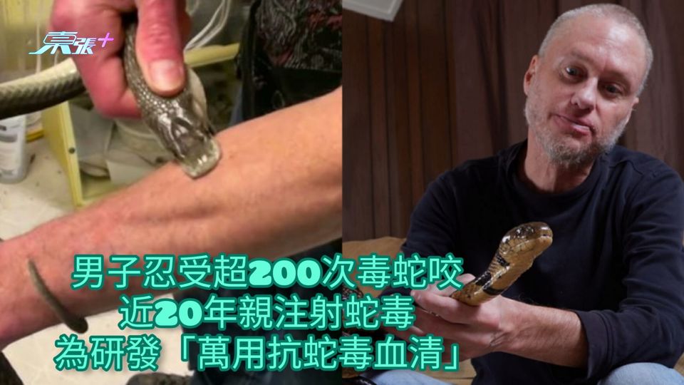 男子忍受超200次毒蛇咬 近20年親注射蛇毒為研發「萬用抗蛇毒血清」