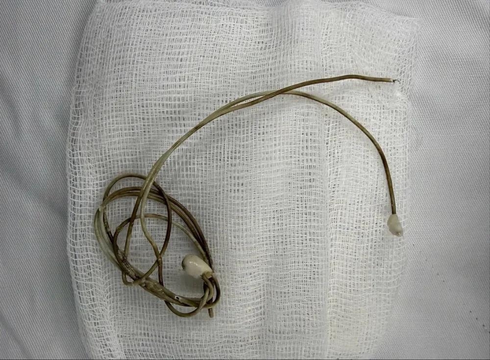 模仿網片釀禍　異物捲成一坨