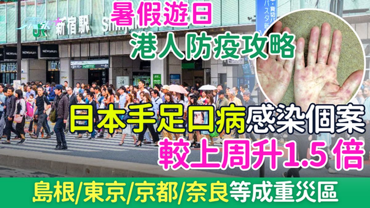 暑假遊日注意｜日本手足口病感染個案較上周升1.5 倍！島根、東京、京都等成重災區 港人遊日防疫攻略
