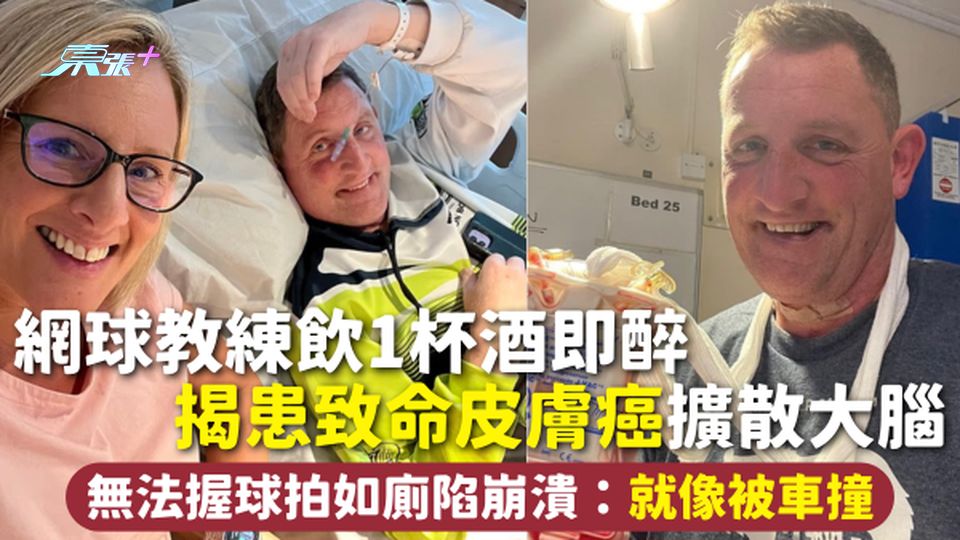 皮膚癌 | 網球教練飲1杯酒即醉 揭患致命皮膚癌擴散大腦 無法握球拍如廁陷崩潰：就像被車撞