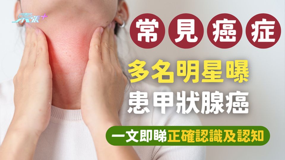 多名明星曝患甲狀腺癌，病因可能係愛動怒？一文即睇正確認識及認知 #至識健康