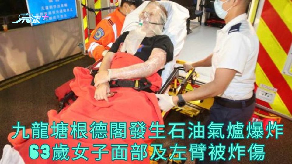 九龍塘根德閣發生石油氣爐爆炸 63歲女子面部及左臂被炸傷