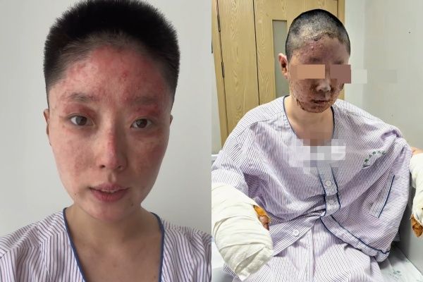 ▲童瑤。（圖／翻攝自微博）