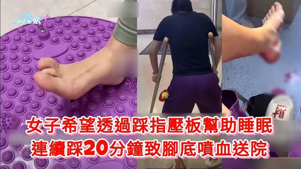 女子希望透過踩指壓板幫助睡眠 連續踩20分鐘致腳底噴血送院