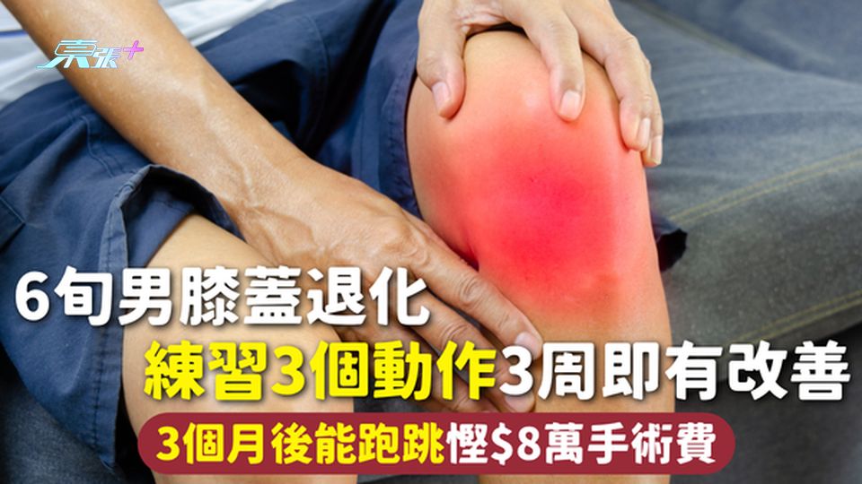 膝蓋退化 | 6旬男膝蓋退化 練習3個動作3周即有改善 3個月後能跑跳慳$8萬手術費