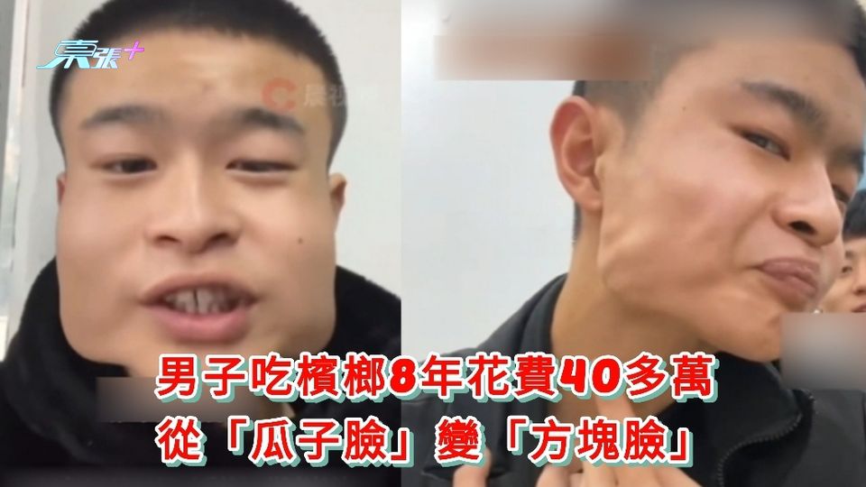 有片|男子吃檳榔8年花費40多萬 從「瓜子臉」變「方塊臉」