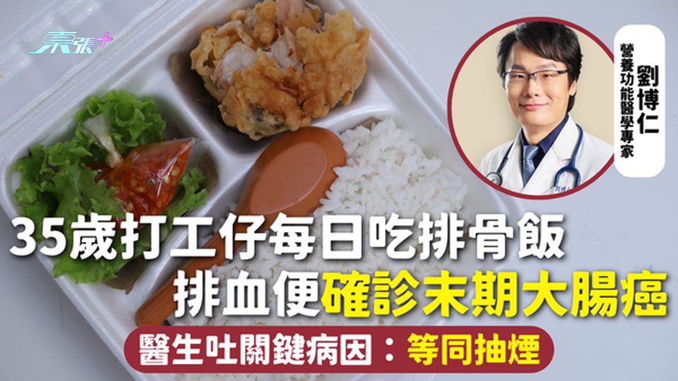 大腸癌 | 35歲打工仔每日吃排骨飯 排血便確診末期大腸癌 醫生吐關鍵病因：等同抽煙