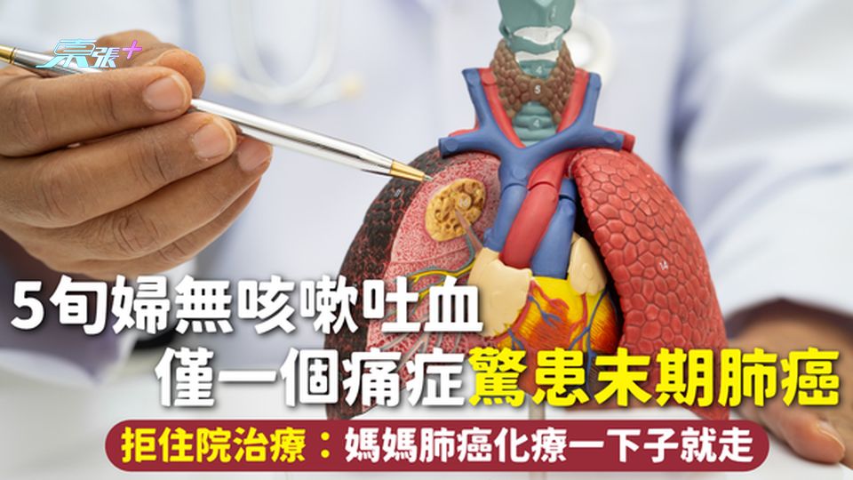 肺癌 | 5旬婦無咳嗽吐血 僅一個痛症驚患末期肺癌 拒住院治療：媽媽肺癌化療一下子就走