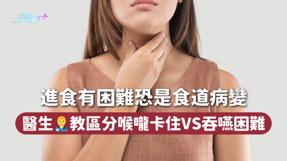 進食有困難恐是食道病變 醫生👨‍⚕️教區分喉嚨卡住VS吞嚥困難